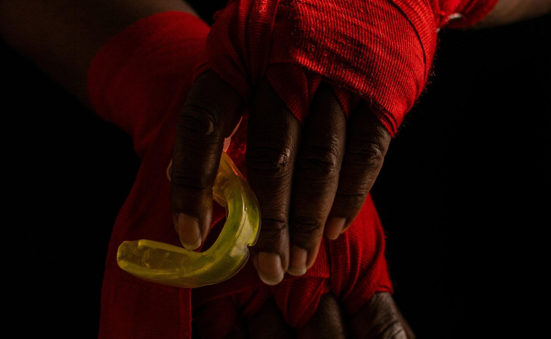 Custom vs. Boil-and-Bite Mouth Guards: Which Is Better for Athletes?