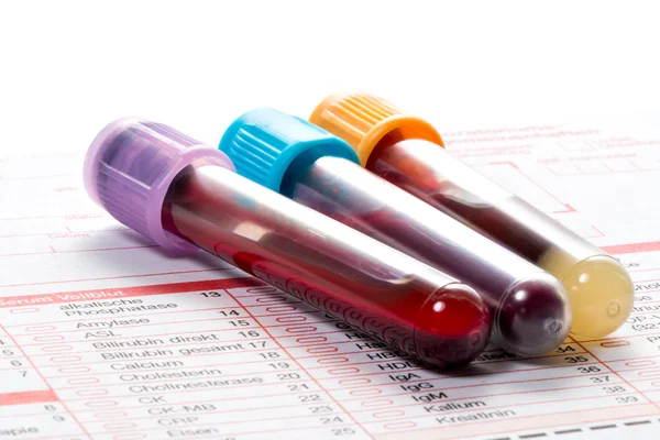 Understanding Private Blood Tests in Solihull What Are Blood Tests and Why Are They Important? Understanding Private Blood Tests in Solihull What Are Blood Tests and Why Are They Important?