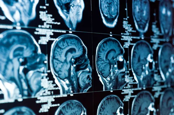 When Should You Contact a California Brain Injury Lawyer? When Should You Contact a California Brain Injury Lawyer?